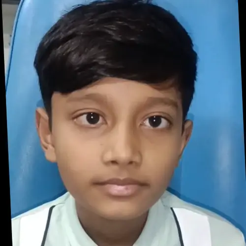 After squint (strabismus) treatment — improved eye alignment, clinical photograph